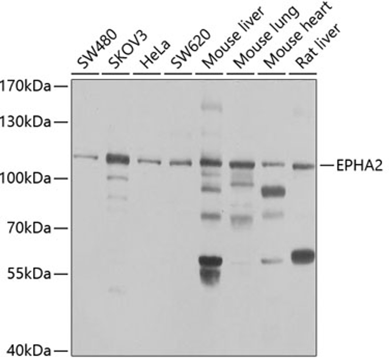 Western blot analysis of extracts of various cell lines, using EPHA2 antibody (22-763) at 1:1000 dilution.<br/>Secondary antibody: HRP Goat Anti-Rabbit IgG (H+L) at 1:10000 dilution.<br/>Lysates/proteins: 25ug per lane.<br/>Blocking buffer: 3% nonfat dry milk in TBST.<br/>Detection: ECL Basic Kit.<br/>Exposure time: 10s.