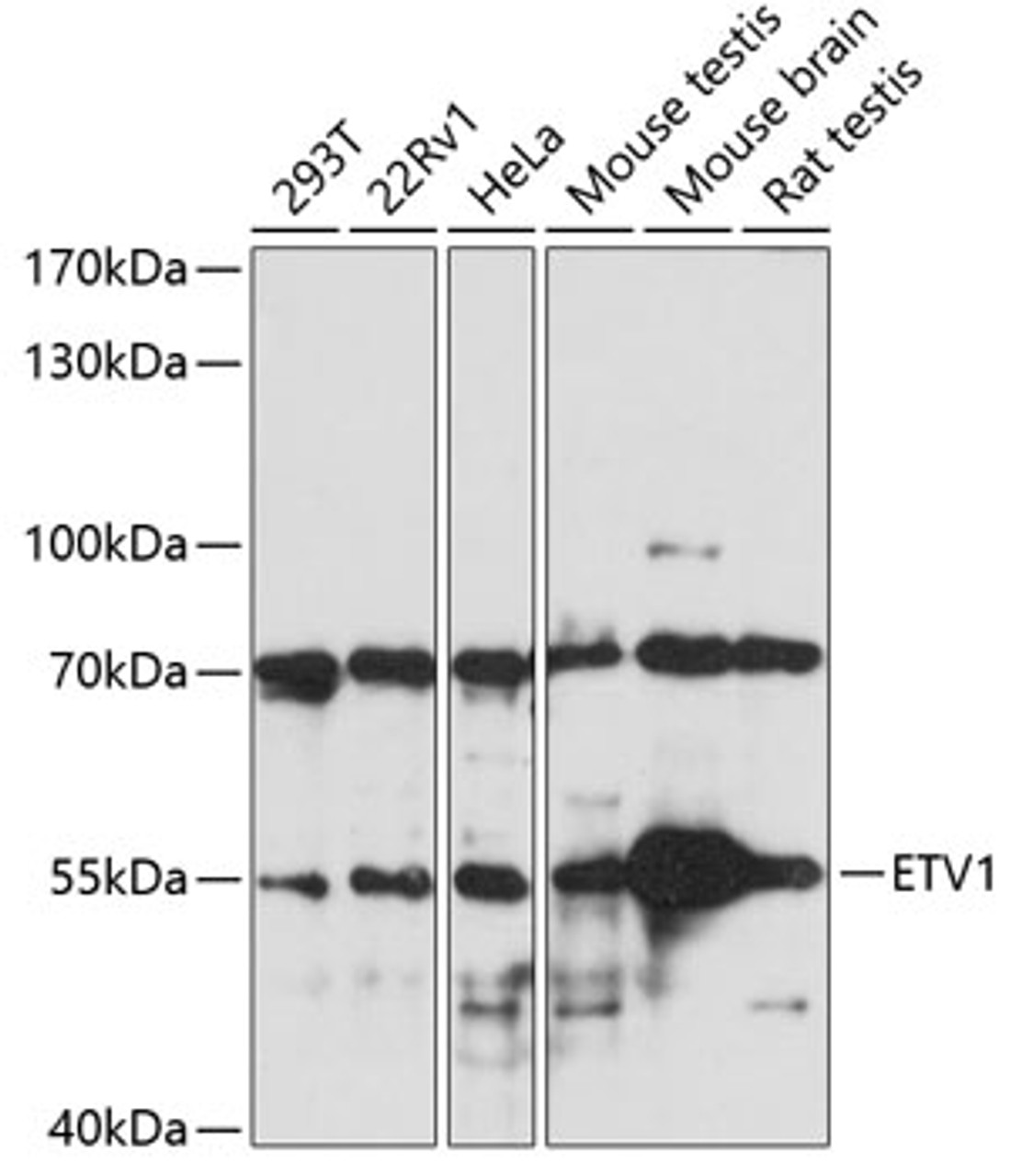 Western blot analysis of extracts of various cell lines, using ETV1 antibody (22-764) at 1:1000 dilution.<br/>Secondary antibody: HRP Goat Anti-Rabbit IgG (H+L) at 1:10000 dilution.<br/>Lysates/proteins: 25ug per lane.<br/>Blocking buffer: 3% nonfat dry milk in TBST.<br/>Detection: ECL Basic Kit.<br/>Exposure time: 10s.