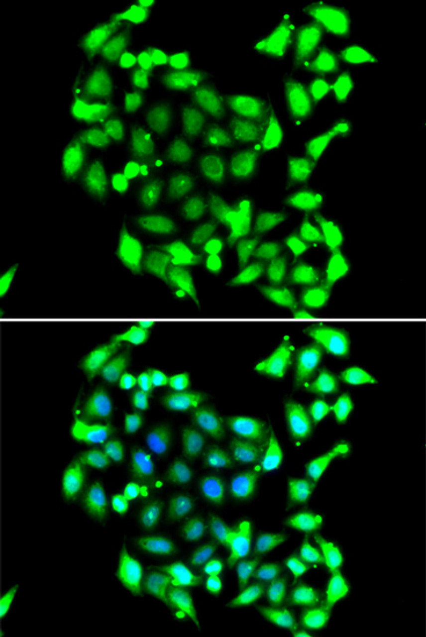 Immunofluorescence analysis of A549 cells using GTF2H3 antibody (22-768) . Blue: DAPI for nuclear staining.
