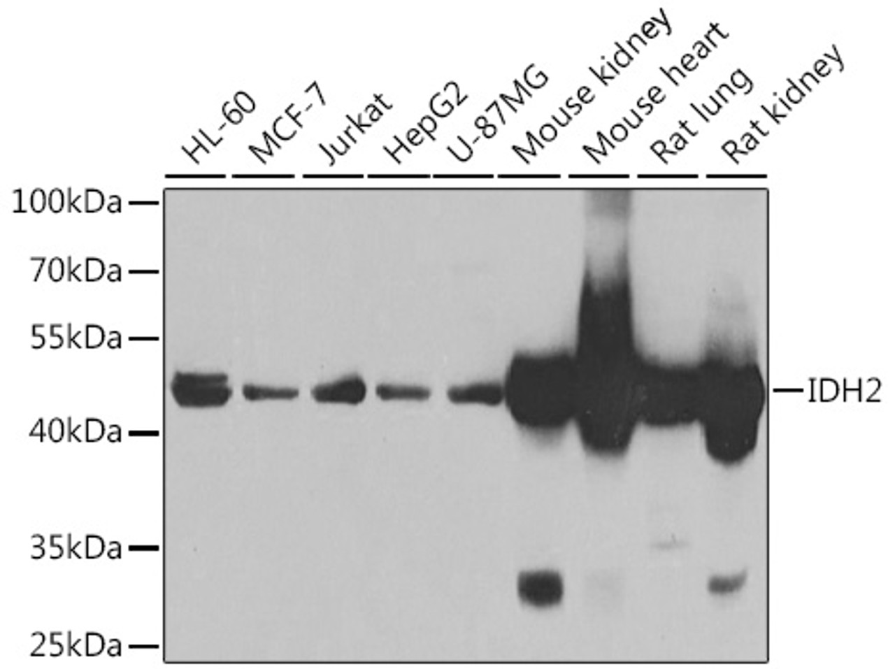 Western blot analysis of extracts of various cell lines, using IDH2 antibody (22-769) at 1:1000 dilution.<br/>Secondary antibody: HRP Goat Anti-Rabbit IgG (H+L) at 1:10000 dilution.<br/>Lysates/proteins: 25ug per lane.<br/>Blocking buffer: 3% nonfat dry milk in TBST.<br/>Detection: ECL Basic Kit.<br/>Exposure time: 90s.