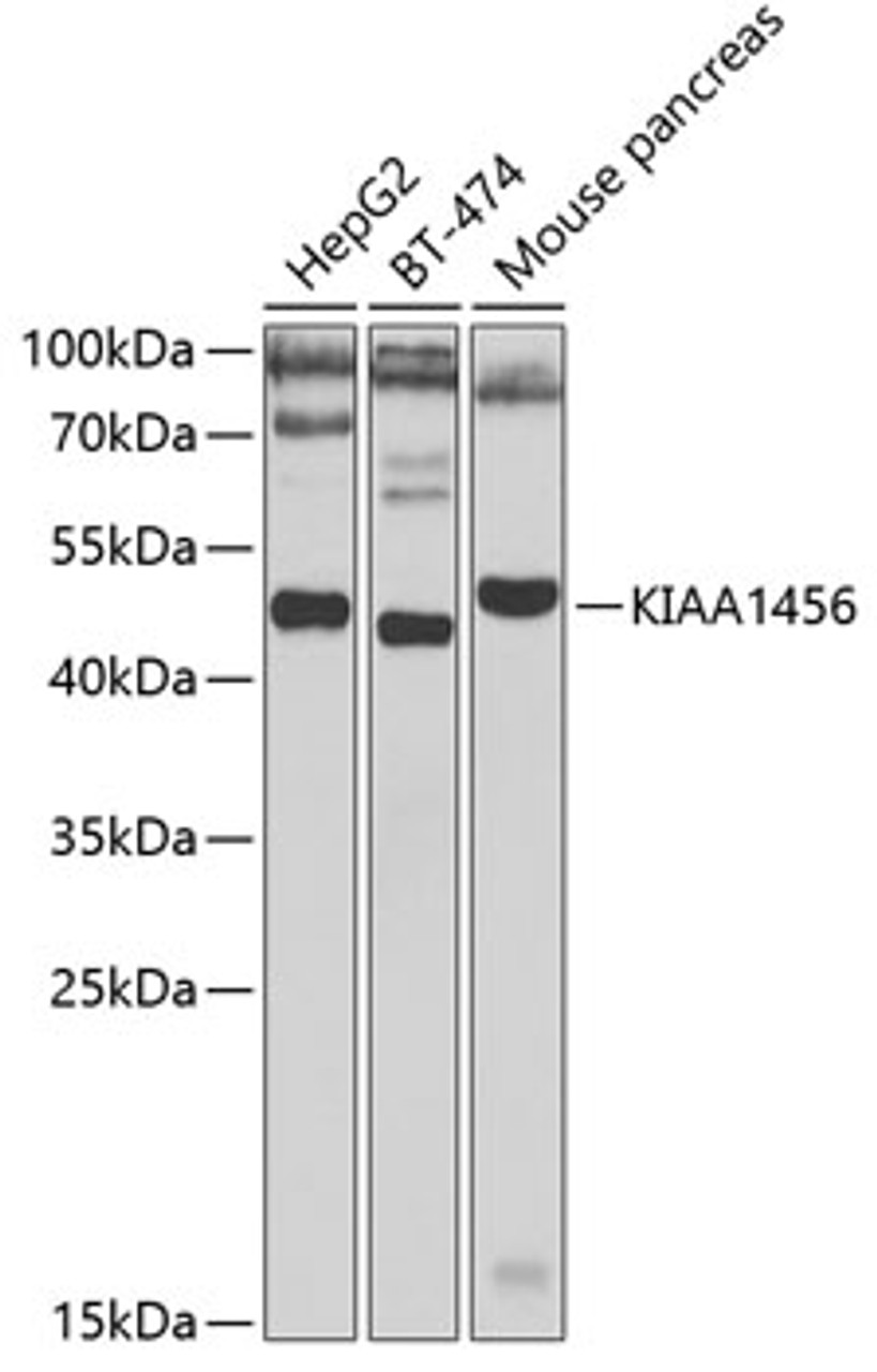 Western blot analysis of extracts of various cell lines, using KIAA1456 antibody (22-772) at 1:1000 dilution.<br/>Secondary antibody: HRP Goat Anti-Rabbit IgG (H+L) at 1:10000 dilution.<br/>Lysates/proteins: 25ug per lane.<br/>Blocking buffer: 3% nonfat dry milk in TBST.<br/>Detection: ECL Basic Kit.<br/>Exposure time: 60s.