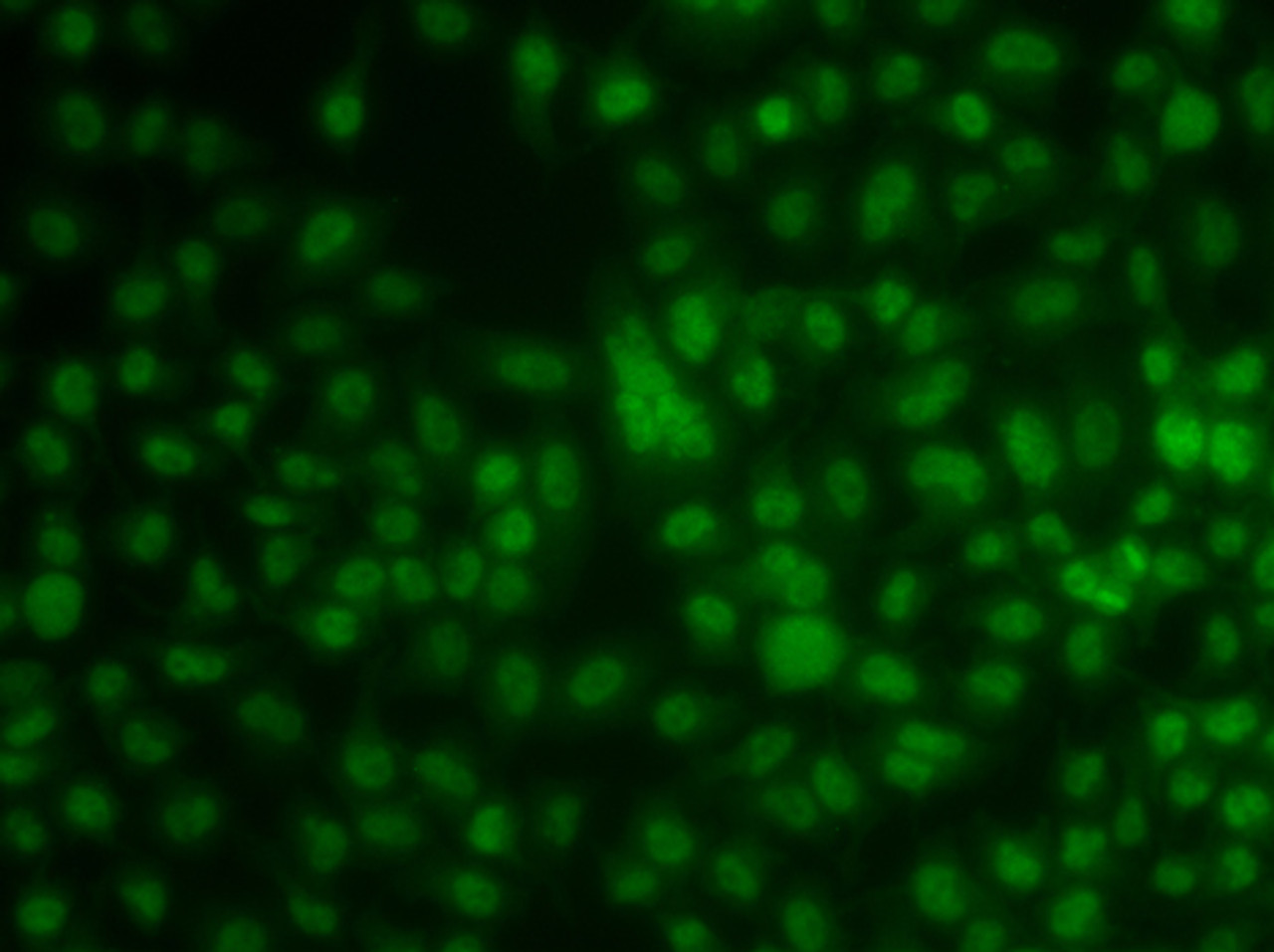 Immunofluorescence analysis of A549 cells using KLF3 antibody (22-773) .