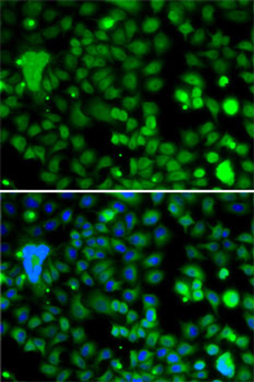 Immunofluorescence analysis of A-549 cells using KLF9 antibody (22-774) . Blue: DAPI for nuclear staining.