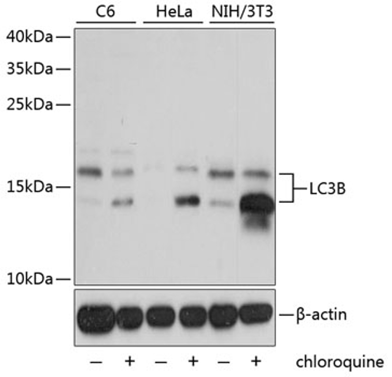 Western blot analysis of extracts of various cell lines, using LC3B antibody (22-775) at 1:1000 dilution. C6 cells were treated by Chloroquine (50 μM) for 20 hours. Hela cells were treated by Chloroquine (50 μM) for 20 hours. NIH/3T3 cells were treated by Chloroquine (50 μM) for 20 hours.<br/>Secondary antibody: HRP Goat Anti-Rabbit IgG (H+L) at 1:10000 dilution.<br/>Lysates/proteins: 25ug per lane.<br/>Blocking buffer: 3% nonfat dry milk in TBST.<br/>Detection: ECL Basic Kit.<br/>Exposure time: 10s.