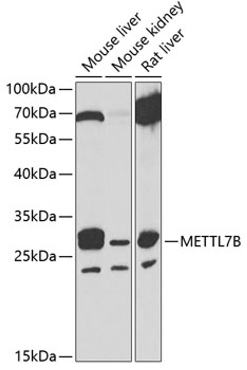 Western blot analysis of extracts of various cell lines, using METTL7B antibody (22-777) at 1:1000 dilution.<br/>Secondary antibody: HRP Goat Anti-Rabbit IgG (H+L) at 1:10000 dilution.<br/>Lysates/proteins: 25ug per lane.<br/>Blocking buffer: 3% nonfat dry milk in TBST.<br/>Detection: ECL Basic Kit.<br/>Exposure time: 90s.