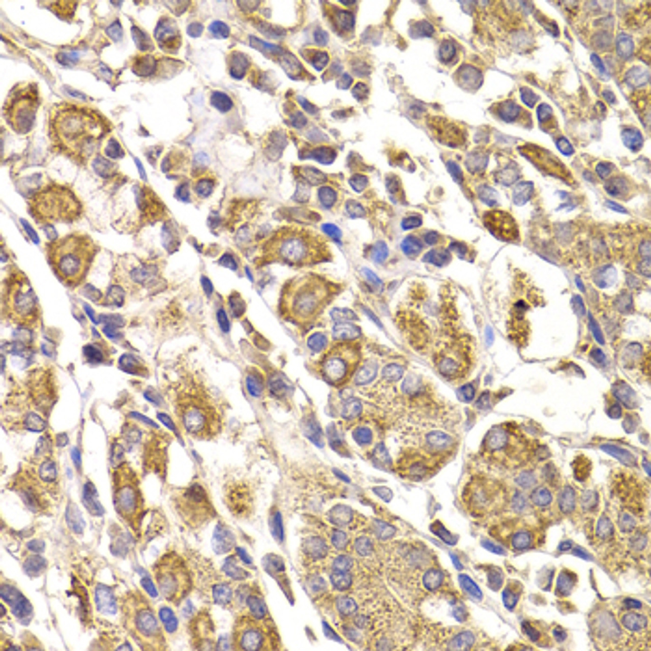 Immunohistochemistry of paraffin-embedded human stomach using METTL7B antibody (22-777) at dilution of 1:100 (40x lens) .