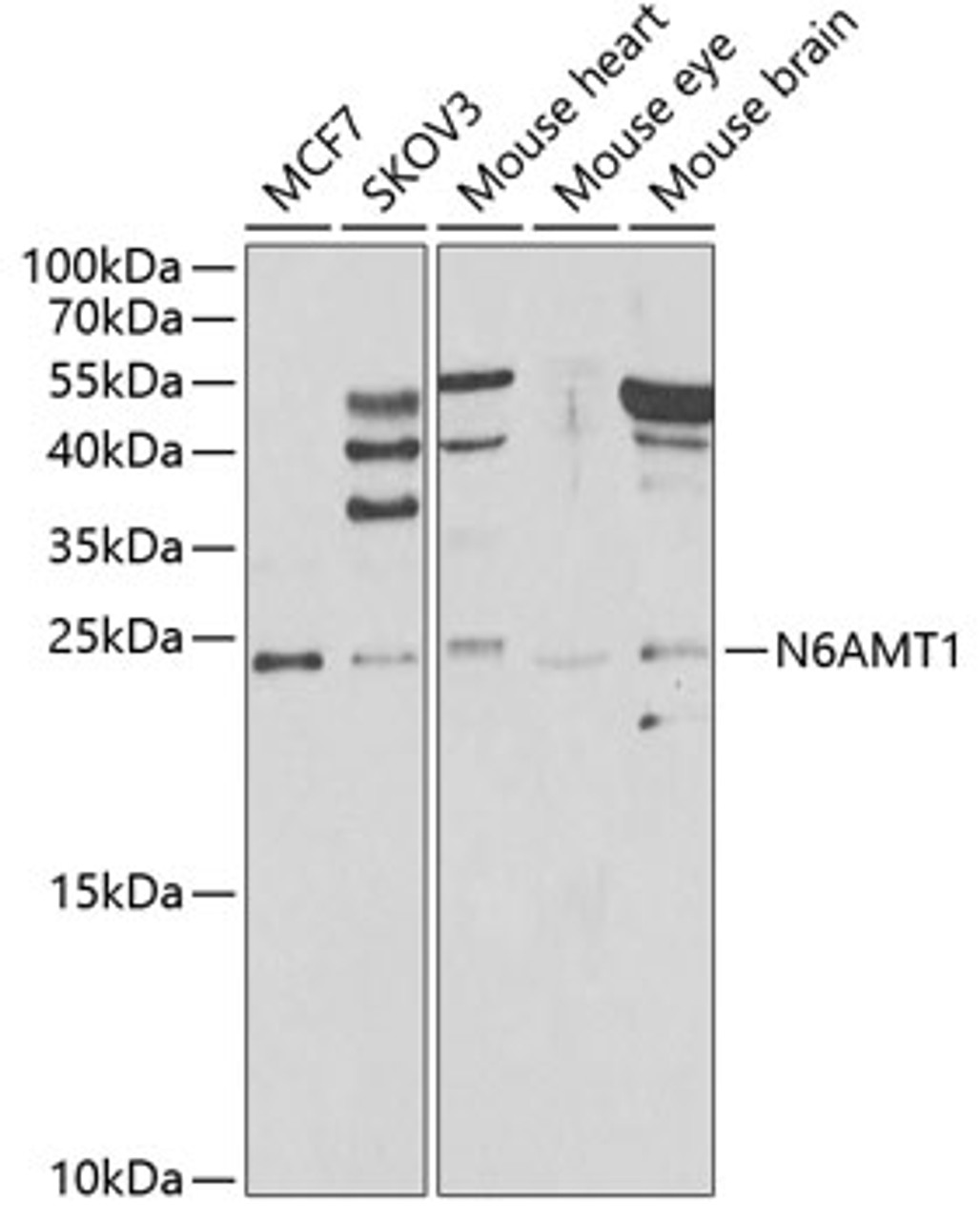 Western blot analysis of extracts of various cell lines, using N6AMT1 antibody (22-778) at 1:1000 dilution._Secondary antibody: HRP Goat Anti-Rabbit IgG (H+L) at 1:10000 dilution._Lysates/proteins: 25ug per lane._Blocking buffer: 3% nonfat dry milk in TBST._Detection: ECL Enhanced Kit._Exposure time: 90s.