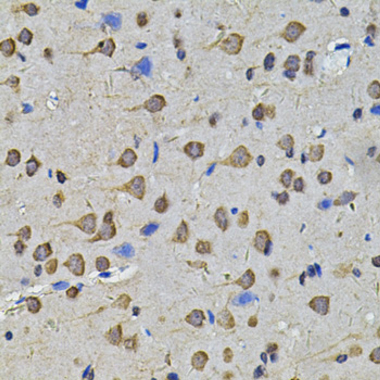 Immunohistochemistry of paraffin-embedded rat brain using N6AMT1 Antibody (22-778) at dilution of 1:100 (40x lens) .