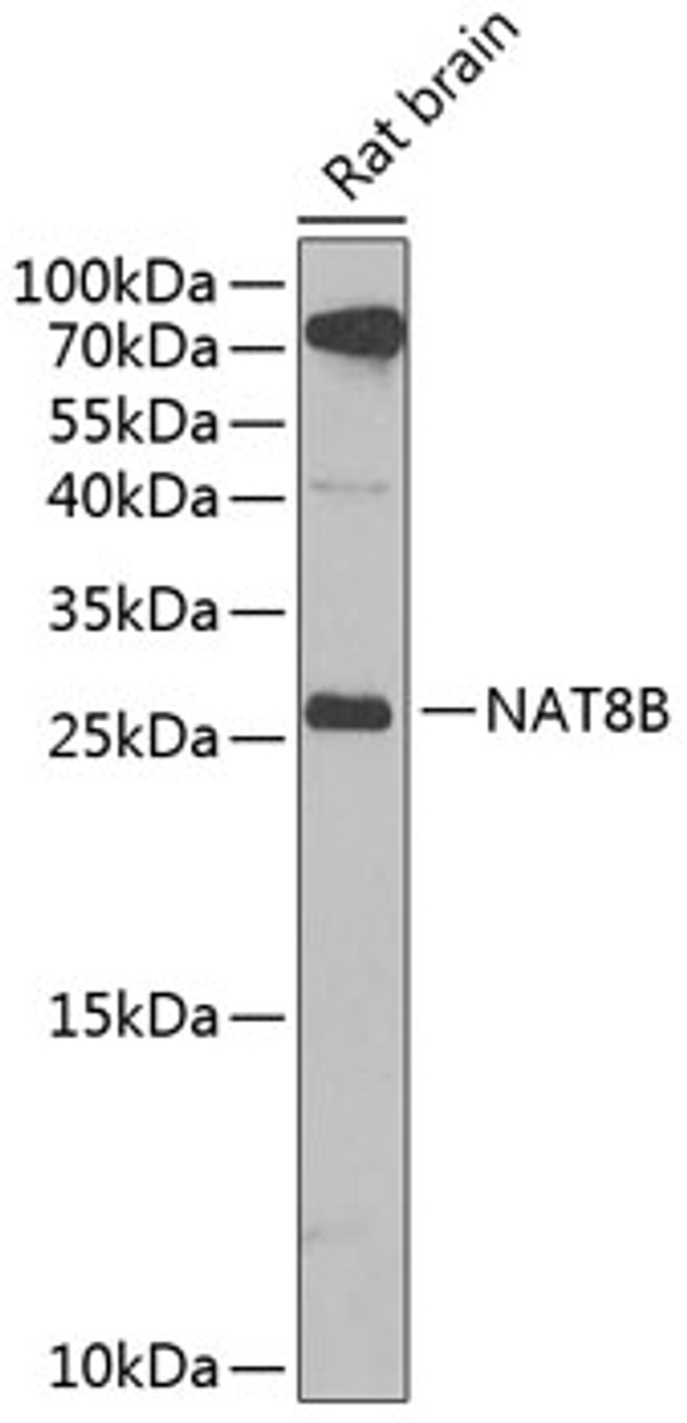 Western blot analysis of extracts of rat brain, using NAT8B antibody (22-780) at 1:1000 dilution.<br/>Secondary antibody: HRP Goat Anti-Rabbit IgG (H+L) at 1:10000 dilution.<br/>Lysates/proteins: 25ug per lane.<br/>Blocking buffer: 3% nonfat dry milk in TBST.<br/>Detection: ECL Enhanced Kit.<br/>Exposure time: 90s.