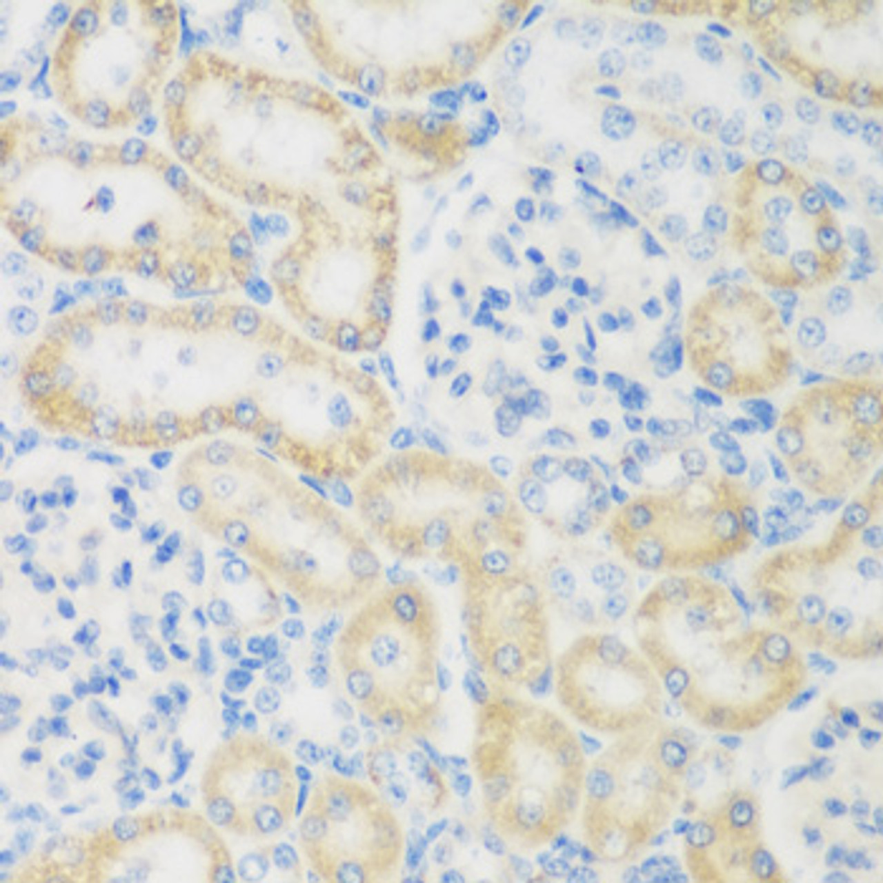 Immunohistochemistry of paraffin-embedded rat kidney using NAT8B antibody (22-780) at dilution of 1:200 (40x lens) .