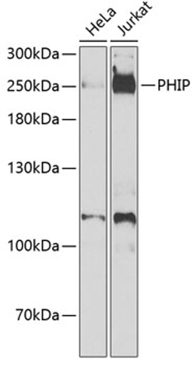 Western blot analysis of extracts of various cell lines, using PHIP antibody (22-784) at 1:1000 dilution._Secondary antibody: HRP Goat Anti-Rabbit IgG (H+L) at 1:10000 dilution._Lysates/proteins: 25ug per lane._Blocking buffer: 3% nonfat dry milk in TBST._Detection: ECL Enhanced Kit._Exposure time: 90s.