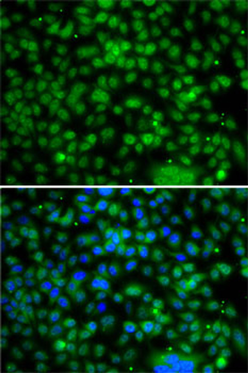 Immunofluorescence analysis of A-549 cells using PHYHD1 antibody (22-785) . Blue: DAPI for nuclear staining.