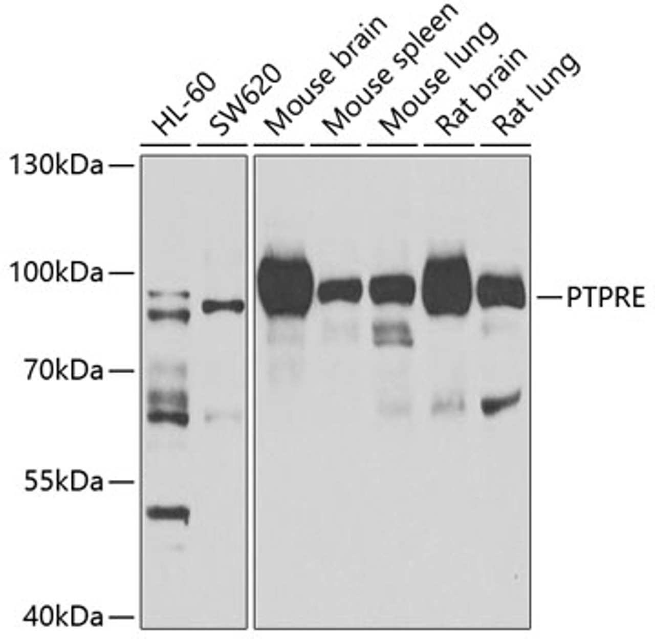 Western blot analysis of extracts of various cell lines, using PTPRE antibody (22-786) at 1:1000 dilution.<br/>Secondary antibody: HRP Goat Anti-Rabbit IgG (H+L) at 1:10000 dilution.<br/>Lysates/proteins: 25ug per lane.<br/>Blocking buffer: 3% nonfat dry milk in TBST.<br/>Detection: ECL Basic Kit.<br/>Exposure time: 90s.