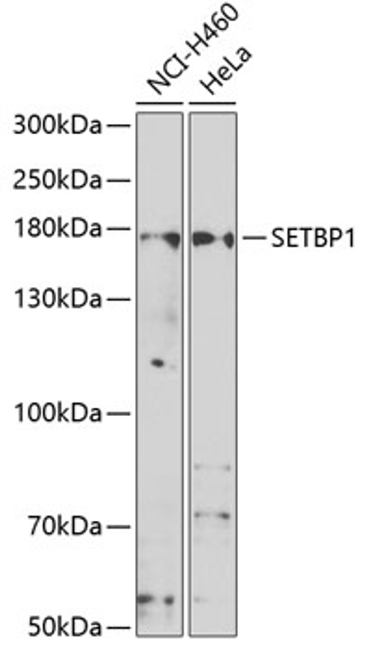 Western blot analysis of extracts of various cell lines, using SETBP1 antibody (22-788) at 1:1000 dilution.<br/>Secondary antibody: HRP Goat Anti-Rabbit IgG (H+L) at 1:10000 dilution.<br/>Lysates/proteins: 25ug per lane.<br/>Blocking buffer: 3% nonfat dry milk in TBST.<br/>Detection: ECL Basic Kit.<br/>Exposure time: 90s.