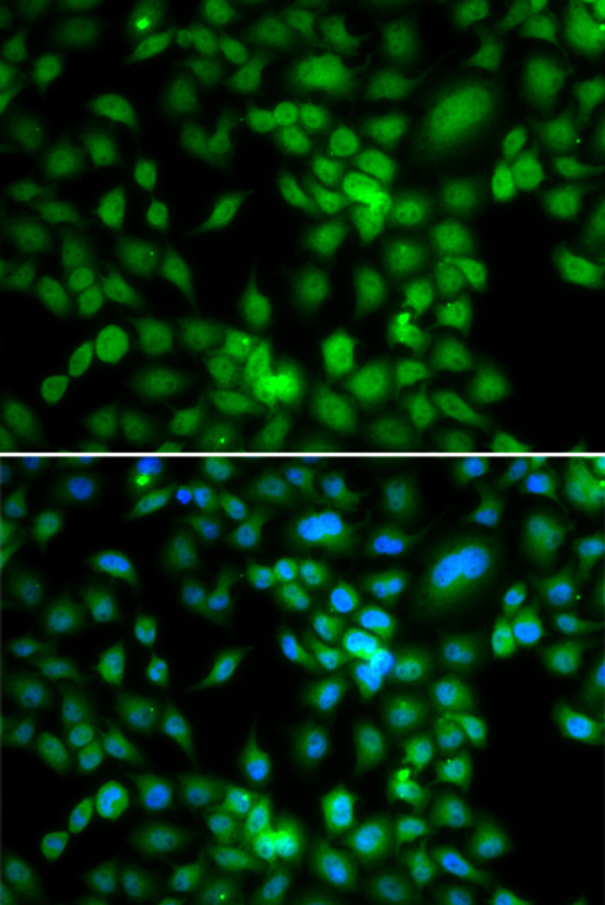 Immunofluorescence analysis of MCF-7 cells using SYCE1 antibody (22-791) . Blue: DAPI for nuclear staining.