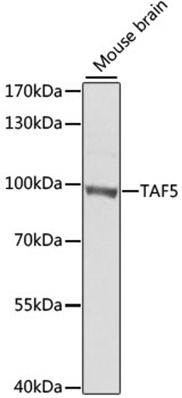 Western blot analysis of extracts of mouse brain, using TAF5 antibody (22-793) at 1:1000 dilution.<br/>Secondary antibody: HRP Goat Anti-Rabbit IgG (H+L) at 1:10000 dilution.<br/>Lysates/proteins: 25ug per lane.<br/>Blocking buffer: 3% nonfat dry milk in TBST.<br/>Detection: ECL Basic Kit.<br/>Exposure time: 90s.