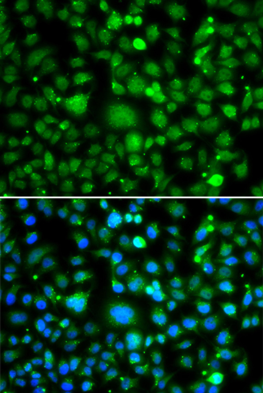 Immunofluorescence analysis of MCF-7 cells using TEK antibody (22-794) . Blue: DAPI for nuclear staining.