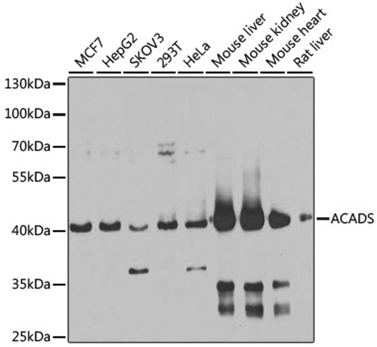 Western blot analysis of extracts of various cell lines, using ACADS antibody (22-798) at 1:1000 dilution.<br/>Secondary antibody: HRP Goat Anti-Rabbit IgG (H+L) at 1:10000 dilution.<br/>Lysates/proteins: 25ug per lane.<br/>Blocking buffer: 3% nonfat dry milk in TBST.<br/>Detection: ECL Basic Kit.<br/>Exposure time: 15s.