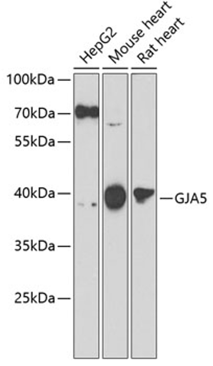 Western blot analysis of extracts of various cell lines, using GJA5 antibody (22-799) at 1:1000 dilution._Secondary antibody: HRP Goat Anti-Rabbit IgG (H+L) at 1:10000 dilution._Lysates/proteins: 25ug per lane._Blocking buffer: 3% nonfat dry milk in TBST._Detection: ECL Enhanced Kit._Exposure time: 60s.