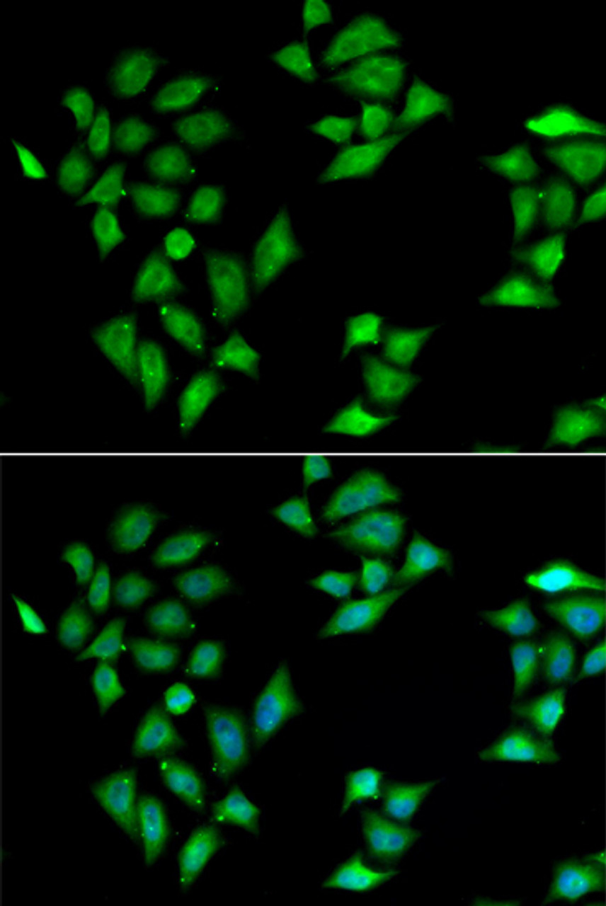 Immunofluorescence analysis of HeLa cells using ITLN1 antibody (22-802) . Blue: DAPI for nuclear staining.