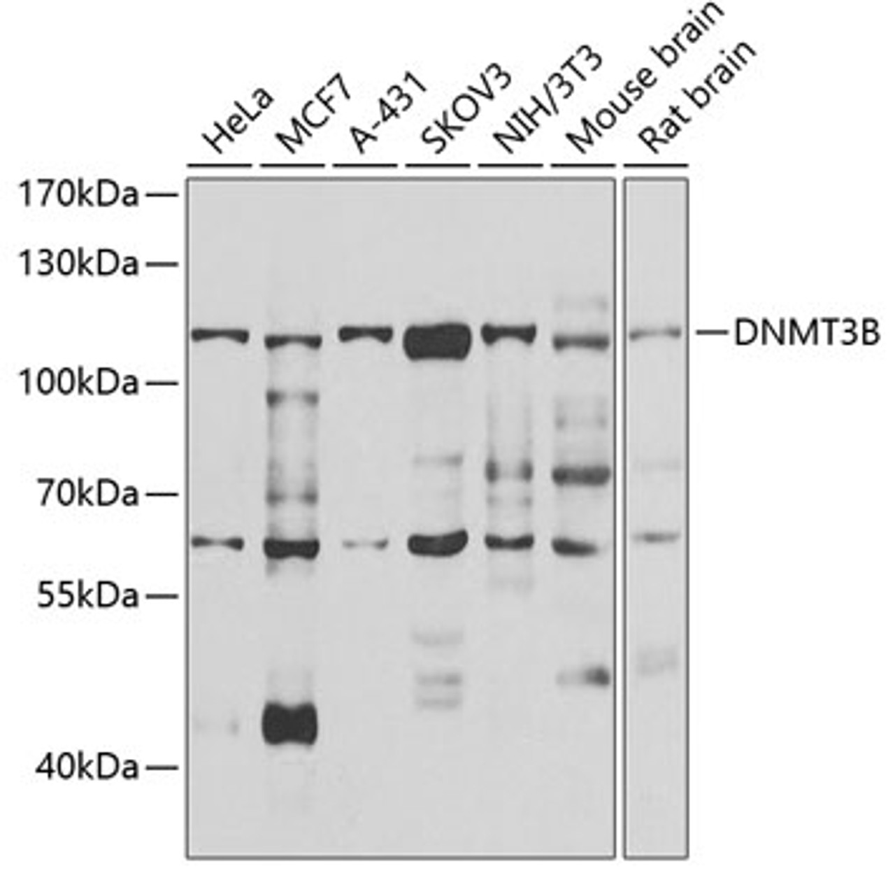 Western blot analysis of extracts of various cell lines, using DNMT3B antibody (22-805) at 1:1000 dilution.<br/>Secondary antibody: HRP Goat Anti-Rabbit IgG (H+L) at 1:10000 dilution.<br/>Lysates/proteins: 25ug per lane.<br/>Blocking buffer: 3% nonfat dry milk in TBST.<br/>Detection: ECL Basic Kit.<br/>Exposure time: 30s.