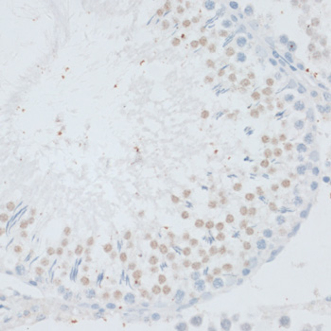 Immunohistochemistry of paraffin-embedded rat testis using DNMT3B antibody (22-805) at dilution of 1:100 (40x lens) .