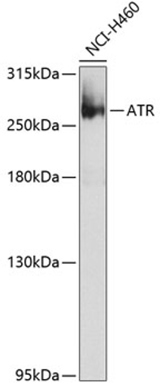 Western blot analysis of extracts of NCI-H460 cells, using ATR Antibody (22-809) at 1:1000 dilution.<br/>Secondary antibody: HRP Goat Anti-Rabbit IgG (H+L) at 1:10000 dilution.<br/>Lysates/proteins: 25ug per lane.<br/>Blocking buffer: 3% nonfat dry milk in TBST.<br/>Detection: ECL Basic Kit.<br/>Exposure time: 60s.