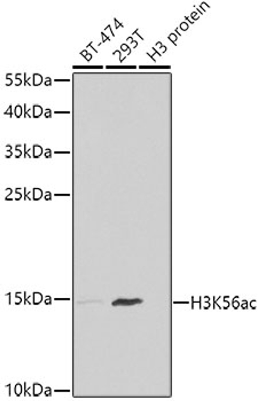 Western blot analysis of extracts of various cell lines, using Acetyl-Histone H3-K56 antibody (22-815) at 1:1000 dilution.<br/>Secondary antibody: HRP Goat Anti-Rabbit IgG (H+L) at 1:10000 dilution.<br/>Lysates/proteins: 25ug per lane.<br/>Blocking buffer: 3% nonfat dry milk in TBST.<br/>Detection: ECL Enhanced Kit.<br/>Exposure time: 90s.