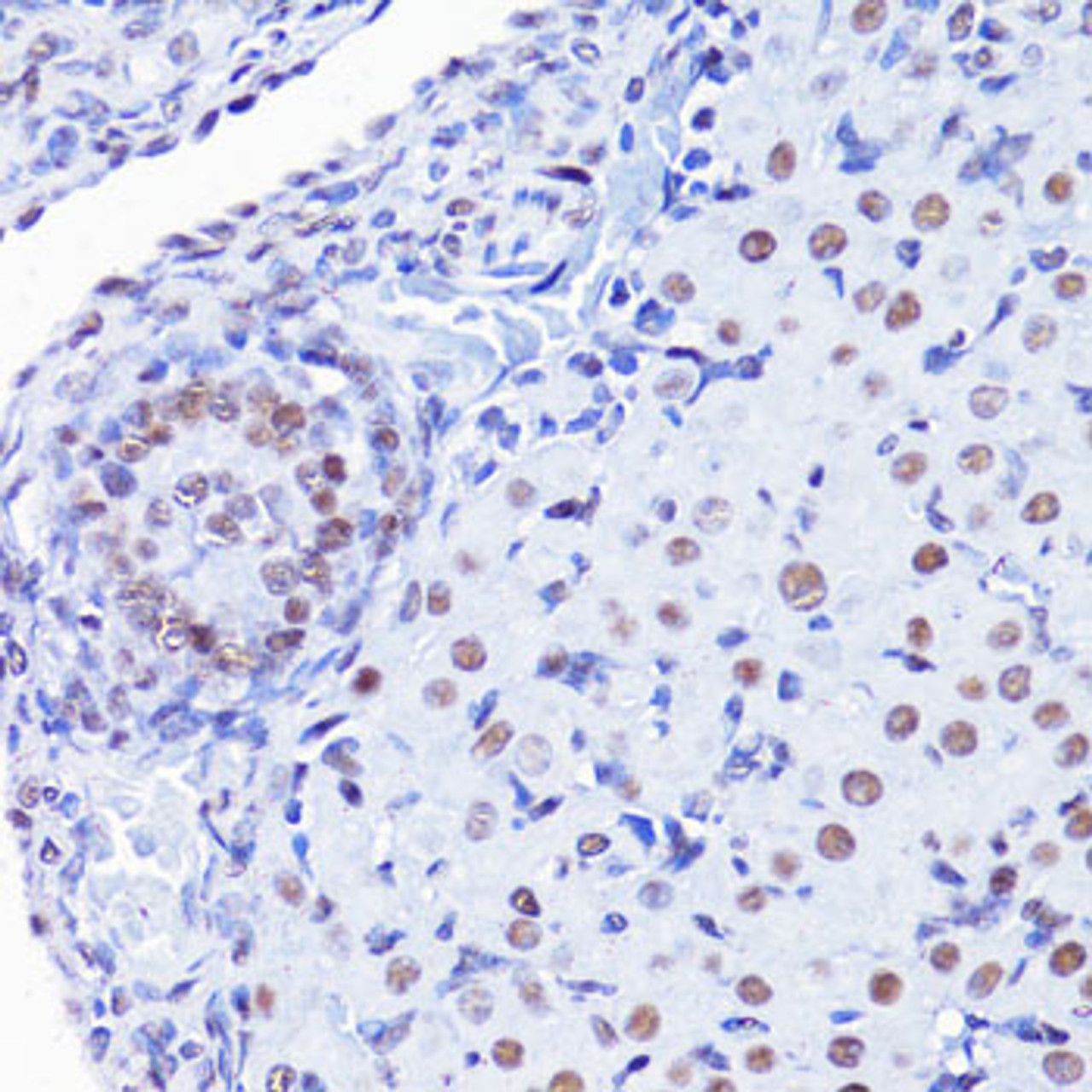 Immunohistochemistry of paraffin-embedded rat ovary using H4K8ac antibody (22-817) at dilution of 1:100 (40x lens) .