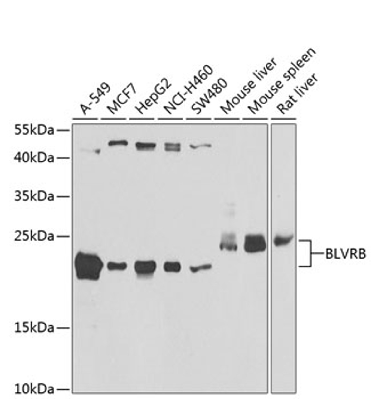 Western blot analysis of extracts of various cell lines, using BLVRB antibody (22-819) at 1:1000 dilution.<br/>Secondary antibody: HRP Goat Anti-Rabbit IgG (H+L) at 1:10000 dilution.<br/>Lysates/proteins: 25ug per lane.<br/>Blocking buffer: 3% nonfat dry milk in TBST.<br/>Detection: ECL Basic Kit.<br/>Exposure time: 90s.