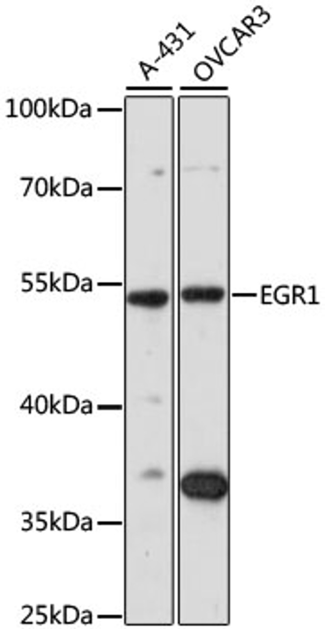 Western blot analysis of extracts of various cell lines, using EGR1 antibody (22-822) at 1:1000 dilution.<br/>Secondary antibody: HRP Goat Anti-Rabbit IgG (H+L) at 1:10000 dilution.<br/>Lysates/proteins: 25ug per lane.<br/>Blocking buffer: 3% nonfat dry milk in TBST.<br/>Detection: ECL Basic Kit.<br/>Exposure time: 90s.