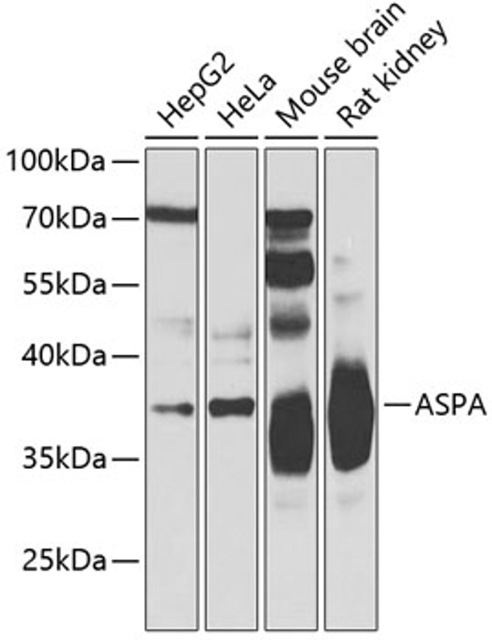 Western blot analysis of extracts of various cell lines, using ASPA Antibody (22-825) at 1:500 dilution.<br/>Secondary antibody: HRP Goat Anti-Rabbit IgG (H+L) at 1:10000 dilution.<br/>Lysates/proteins: 25ug per lane.<br/>Blocking buffer: 3% nonfat dry milk in TBST.<br/>Detection: ECL Basic Kit.<br/>Exposure time: 10s.