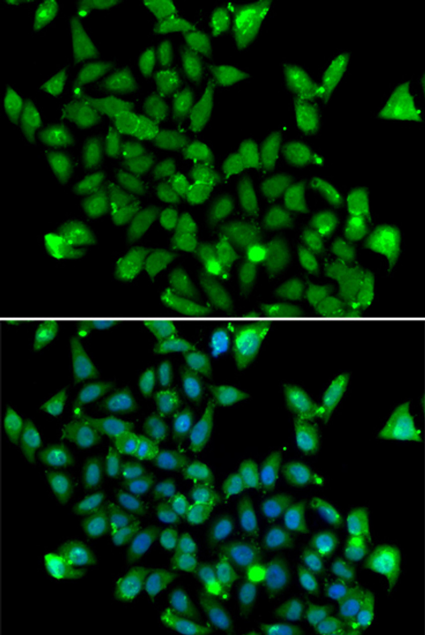 Immunofluorescence analysis of MCF-7 cells using ASPA antibody (22-825) . Blue: DAPI for nuclear staining.