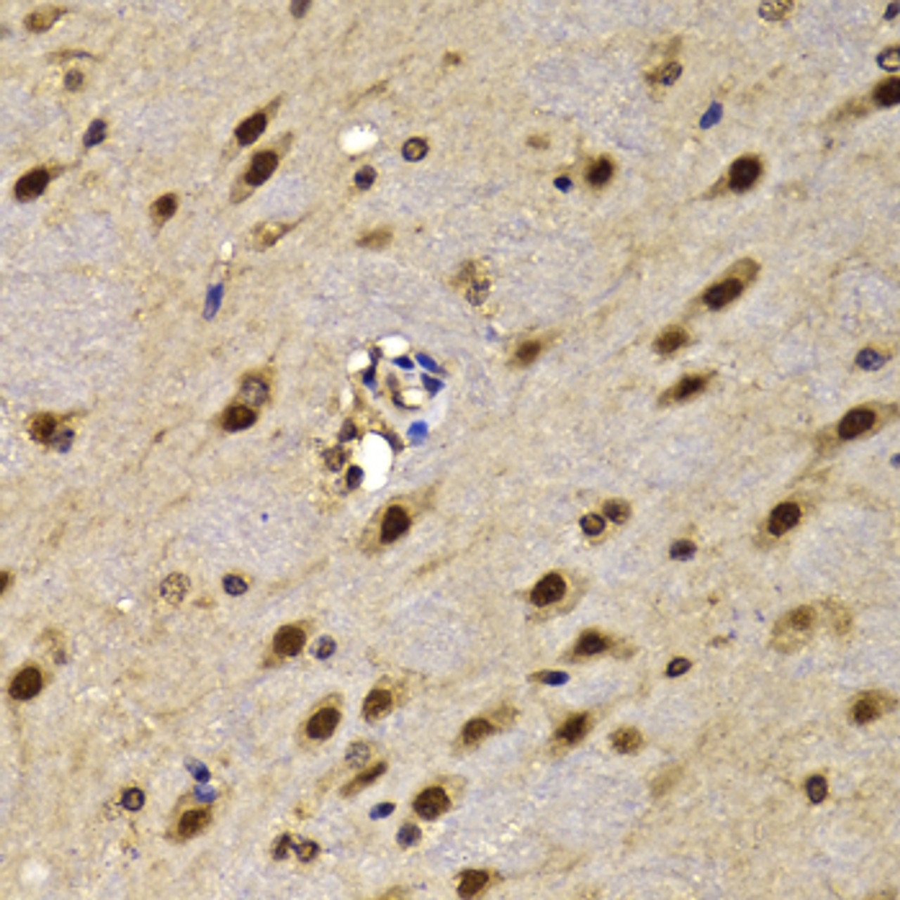 Immunohistochemistry of paraffin-embedded mouse brain using HMG20A antibody (22-836) at dilution of 1:100 (40x lens) .