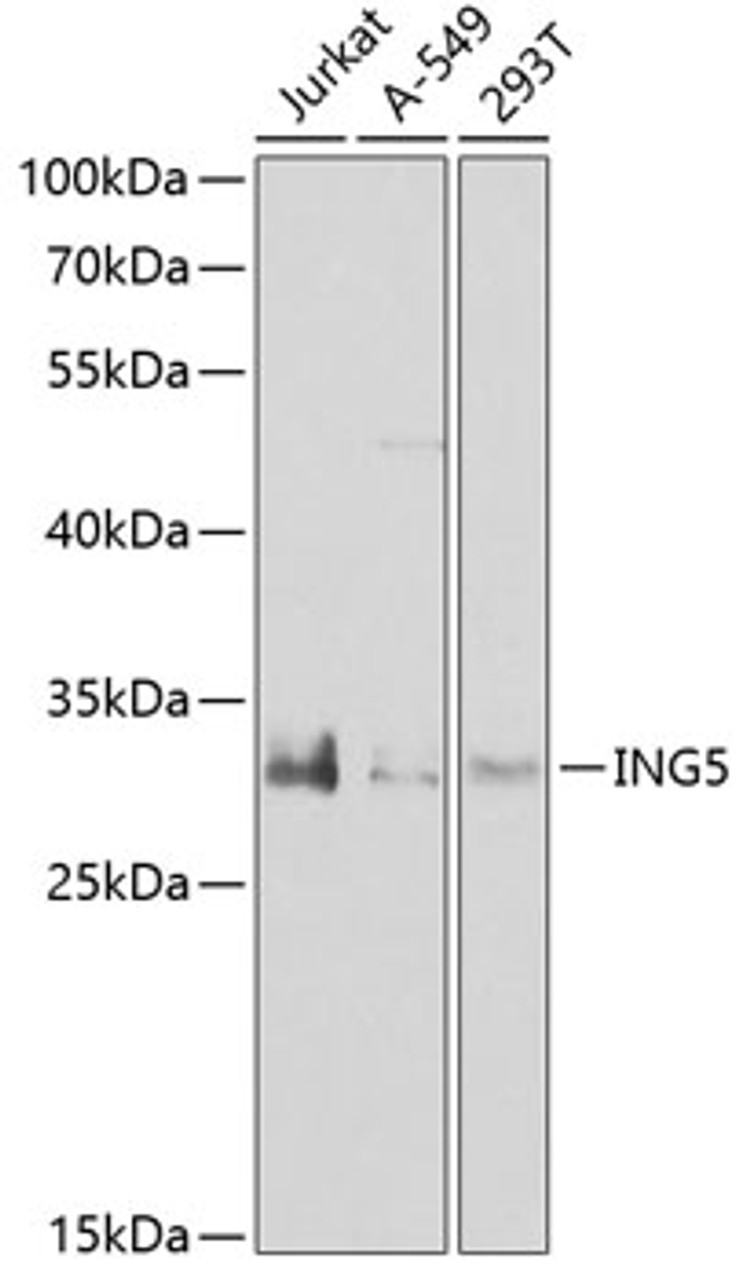 Western blot analysis of extracts of various cell lines, using ING5 antibody (22-837) at 1:1000 dilution._Secondary antibody: HRP Goat Anti-Rabbit IgG (H+L) at 1:10000 dilution._Lysates/proteins: 25ug per lane._Blocking buffer: 3% nonfat dry milk in TBST._Detection: ECL Enhanced Kit._Exposure time: 90s.