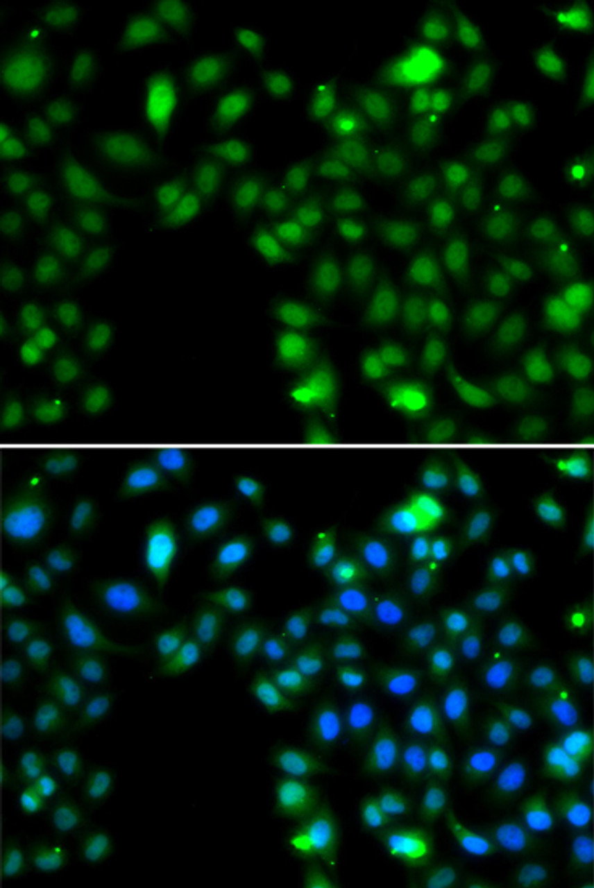 Immunofluorescence analysis of MCF-7 cells using ING5 antibody (22-837) . Blue: DAPI for nuclear staining.