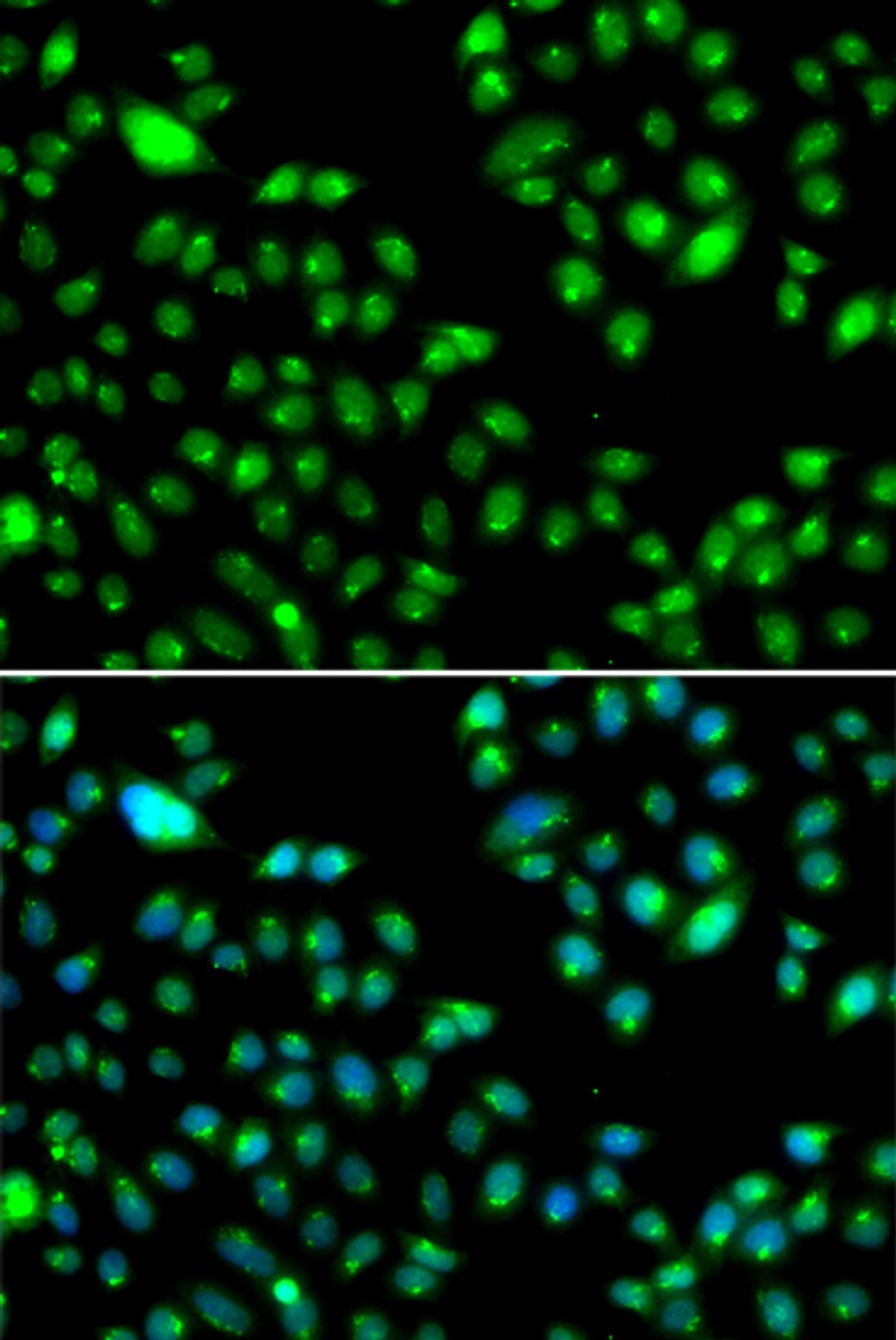 Immunofluorescence analysis of MCF-7 cells using L3MBTL3 antibody (22-838) . Blue: DAPI for nuclear staining.