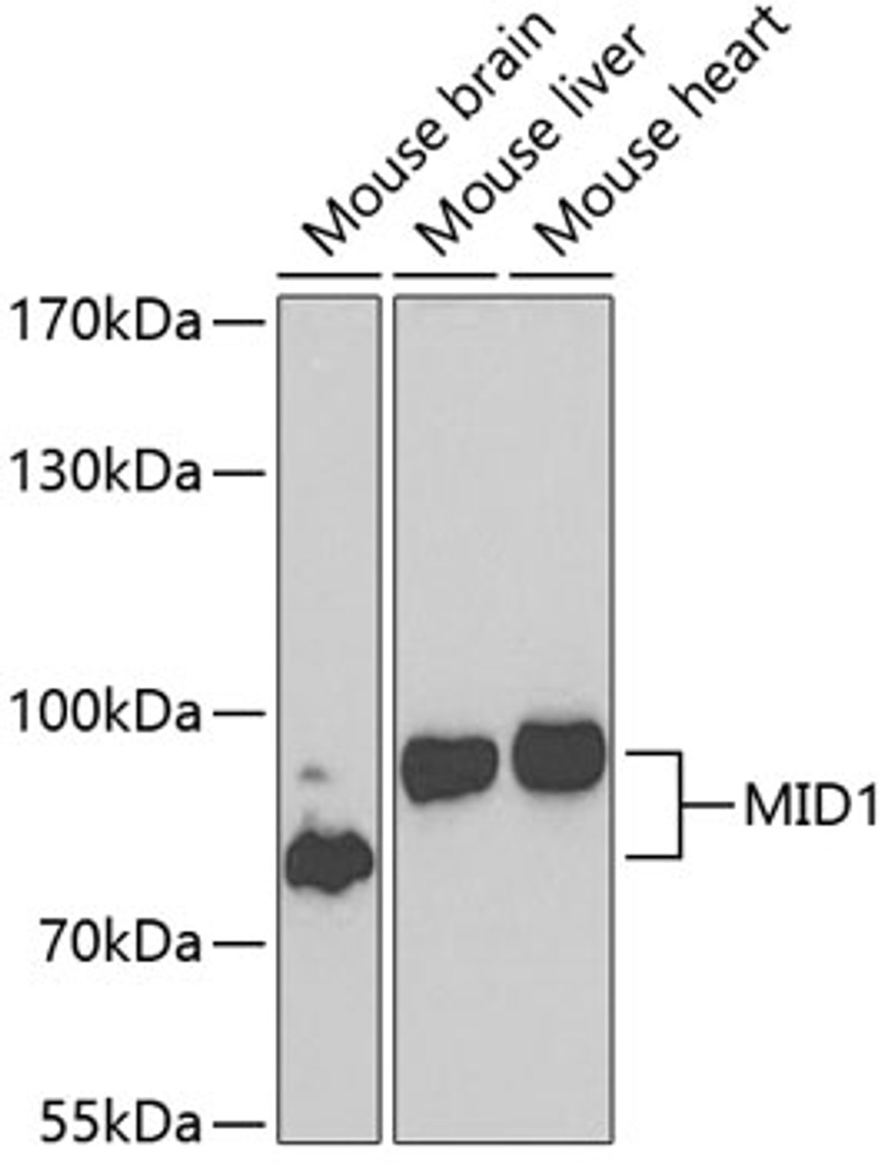 Western blot analysis of extracts of various cell lines, using MID1 antibody (22-839) at 1:1000 dilution._Secondary antibody: HRP Goat Anti-Rabbit IgG (H+L) at 1:10000 dilution._Lysates/proteins: 25ug per lane._Blocking buffer: 3% nonfat dry milk in TBST._Detection: ECL Enhanced Kit._Exposure time: 90s.