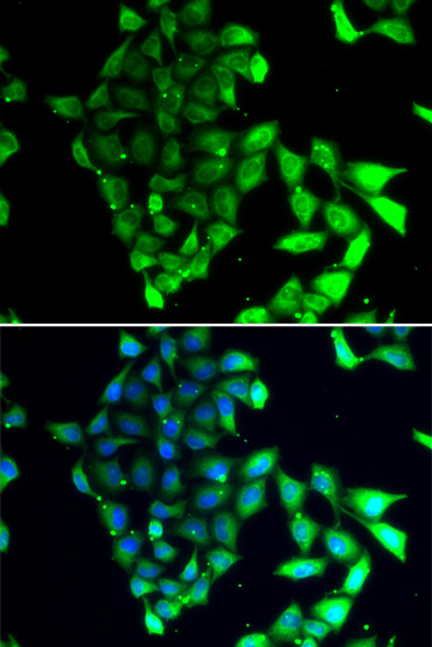 Immunofluorescence analysis of MCF-7 cells using MID1 antibody (22-839) . Blue: DAPI for nuclear staining.