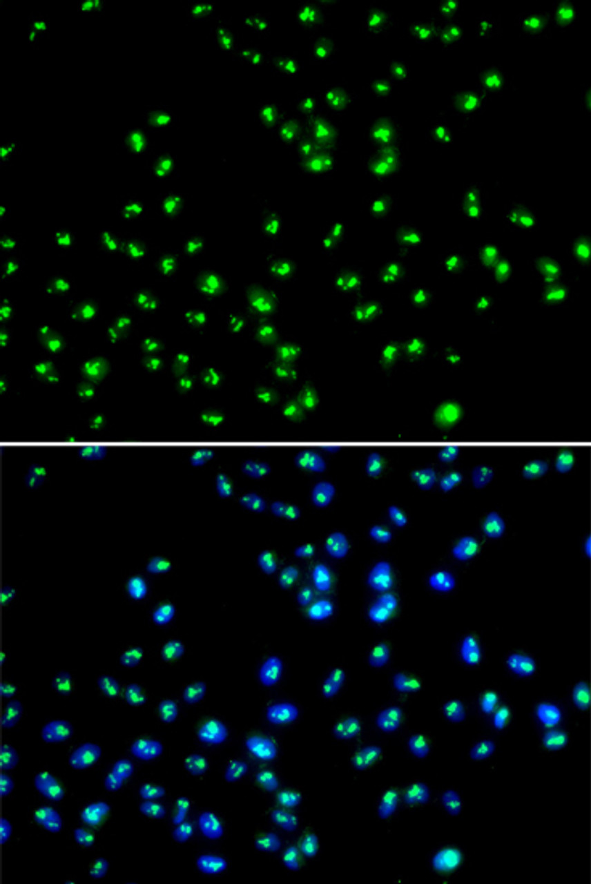 Immunofluorescence analysis of MCF-7 cells using NAT10 antibody (22-840) . Blue: DAPI for nuclear staining.