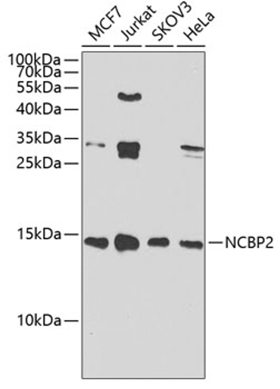 Western blot analysis of extracts of various cell lines, using NCBP2 antibody (22-841) at 1:1000 dilution.<br/>Secondary antibody: HRP Goat Anti-Rabbit IgG (H+L) at 1:10000 dilution.<br/>Lysates/proteins: 25ug per lane.<br/>Blocking buffer: 3% nonfat dry milk in TBST.<br/>Detection: ECL Basic Kit.<br/>Exposure time: 90s.