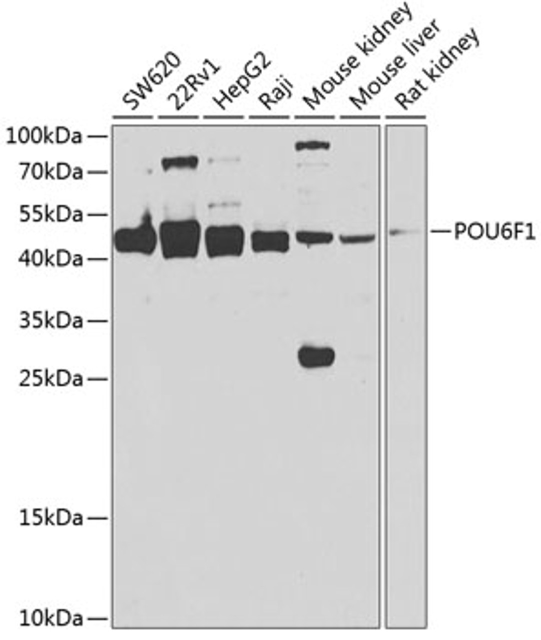 Western blot analysis of extracts of various cell lines, using POU6F1 antibody (22-845) at 1:1000 dilution._Secondary antibody: HRP Goat Anti-Rabbit IgG (H+L) at 1:10000 dilution._Lysates/proteins: 25ug per lane._Blocking buffer: 3% nonfat dry milk in TBST._Detection: ECL Enhanced Kit._Exposure time: 90s.