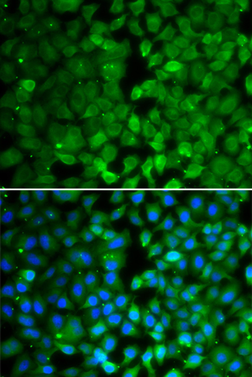 Immunofluorescence analysis of MCF-7 cells using RUNX3 antibody (22-848) . Blue: DAPI for nuclear staining.