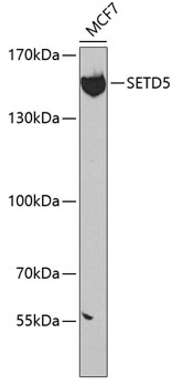 Western blot analysis of extracts of MCF-7 cells, using SETD5 antibody (22-849) at 1:300 dilution.<br/>Secondary antibody: HRP Goat Anti-Rabbit IgG (H+L) at 1:10000 dilution.<br/>Lysates/proteins: 25ug per lane.<br/>Blocking buffer: 3% nonfat dry milk in TBST.<br/>Detection: ECL Basic Kit.<br/>Exposure time: 90s.
