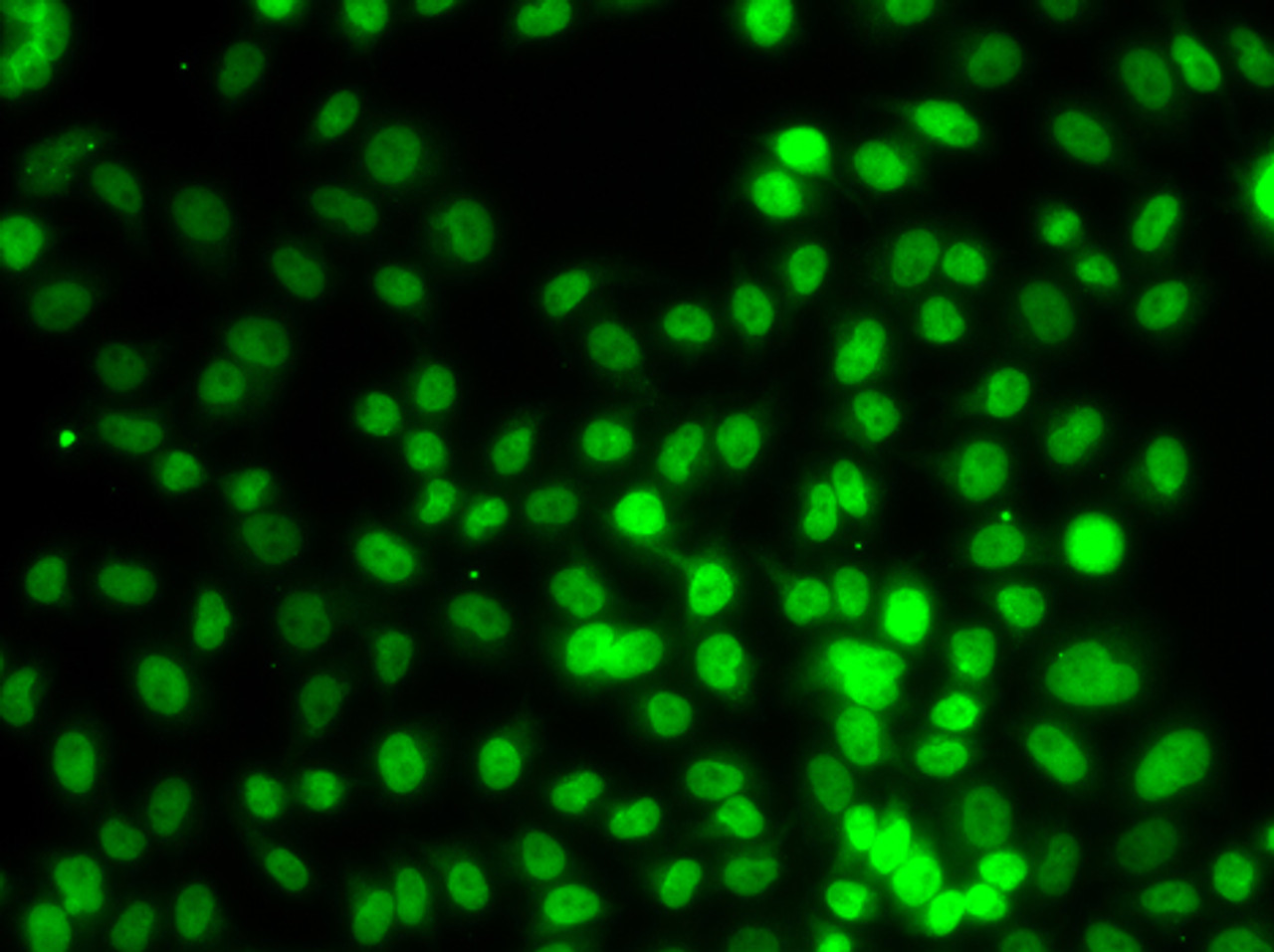 Immunofluorescence analysis of MCF-7 cells using SETD8 antibody (22-850) .