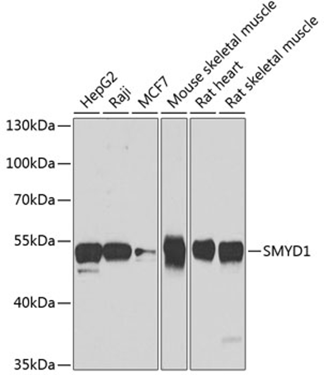 Western blot analysis of extracts of various cell lines, using SMYD1 antibody (22-852) at 1:1000 dilution.<br/>Secondary antibody: HRP Goat Anti-Rabbit IgG (H+L) at 1:10000 dilution.<br/>Lysates/proteins: 25ug per lane.<br/>Blocking buffer: 3% nonfat dry milk in TBST.<br/>Detection: ECL Basic Kit.<br/>Exposure time: 60s.