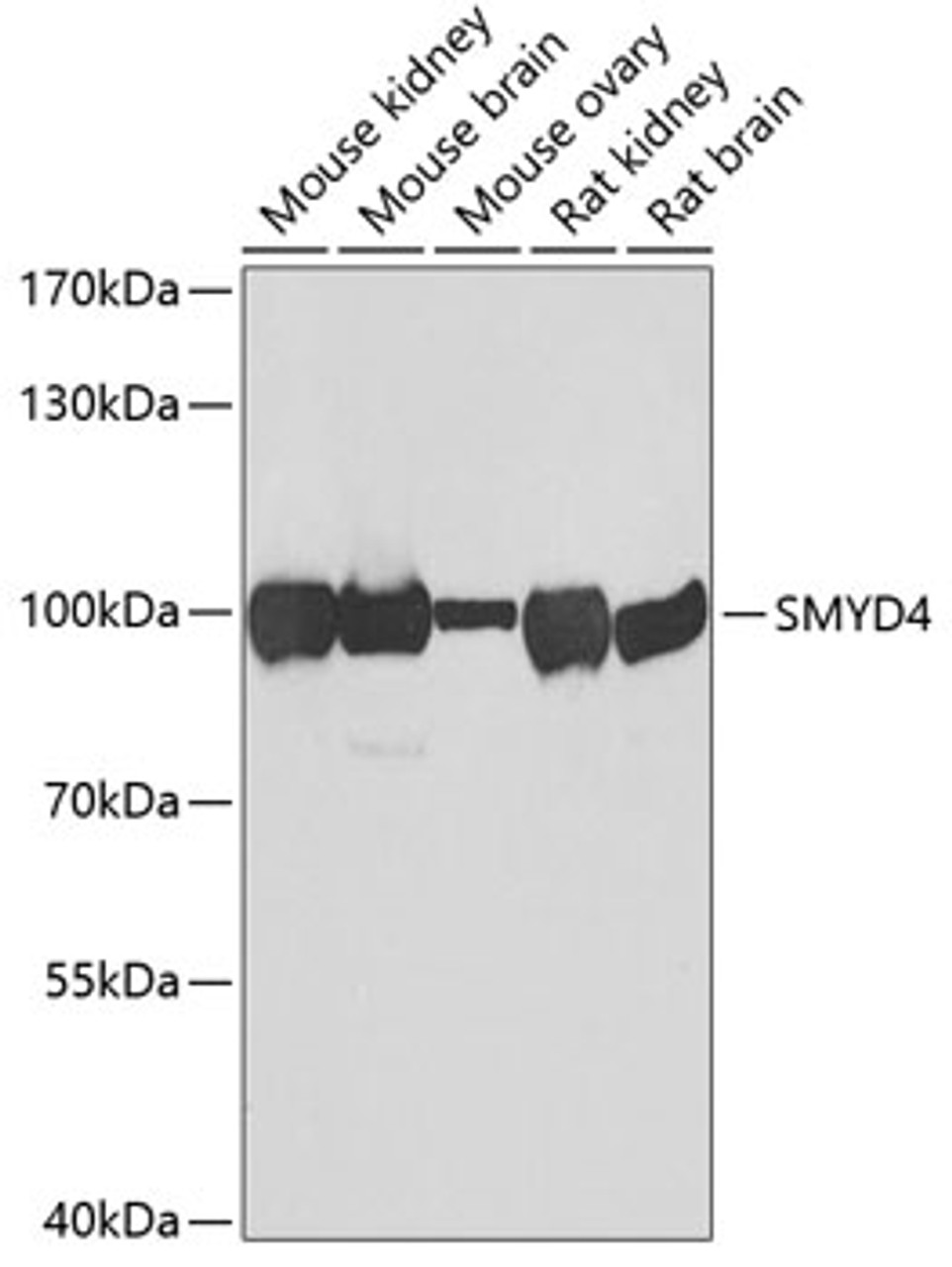 Western blot analysis of extracts of various cell lines, using SMYD4 antibody (22-854) at 1:1000 dilution.<br/>Secondary antibody: HRP Goat Anti-Rabbit IgG (H+L) at 1:10000 dilution.<br/>Lysates/proteins: 25ug per lane.<br/>Blocking buffer: 3% nonfat dry milk in TBST.<br/>Detection: ECL Basic Kit.<br/>Exposure time: 60s.