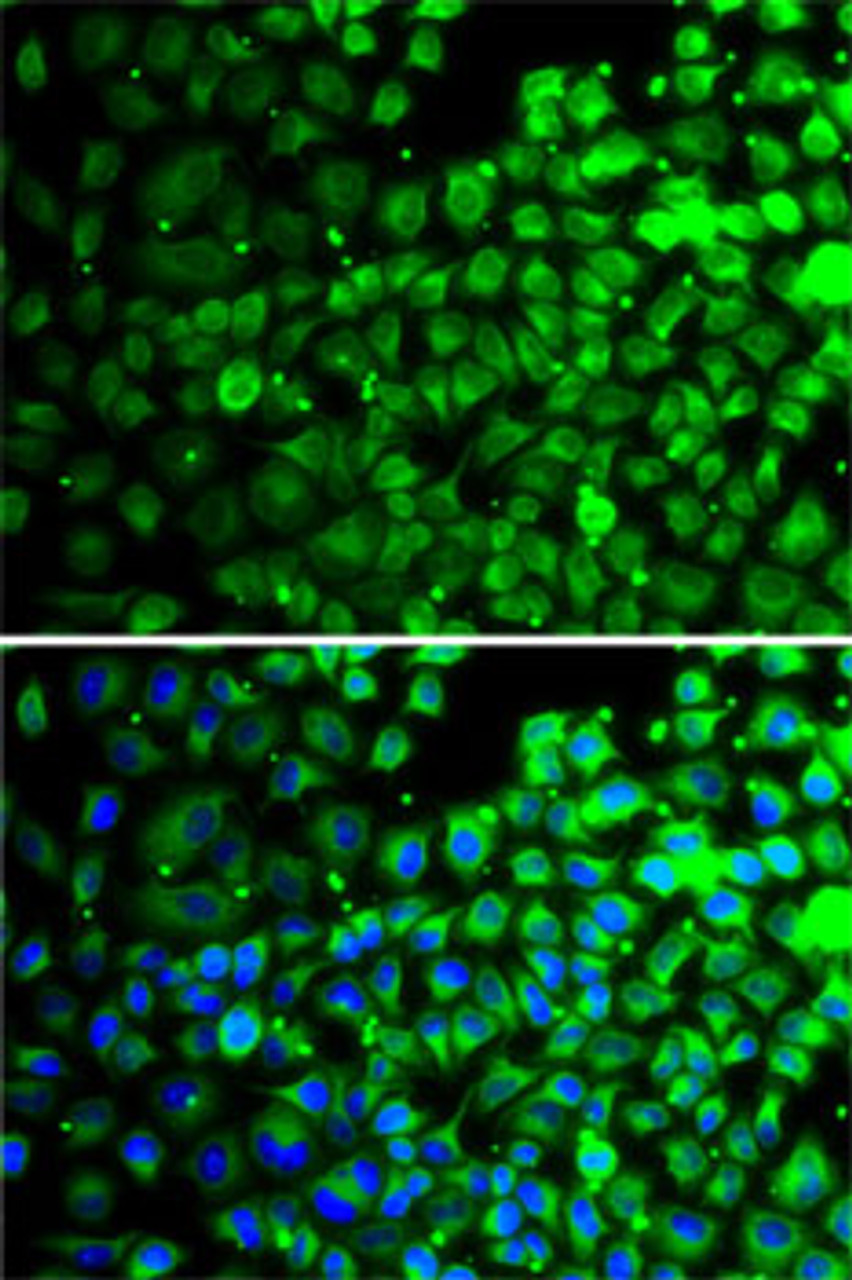 Immunofluorescence analysis of A-549 cells using TXNDC5 antibody (22-857) . Blue: DAPI for nuclear staining.