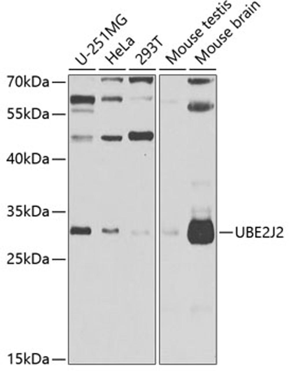 Western blot analysis of extracts of various cell lines, using UBE2J2 antibody (22-858) at 1:1000 dilution._Secondary antibody: HRP Goat Anti-Rabbit IgG (H+L) at 1:10000 dilution._Lysates/proteins: 25ug per lane._Blocking buffer: 3% nonfat dry milk in TBST._Detection: ECL Enhanced Kit._Exposure time: 90s.