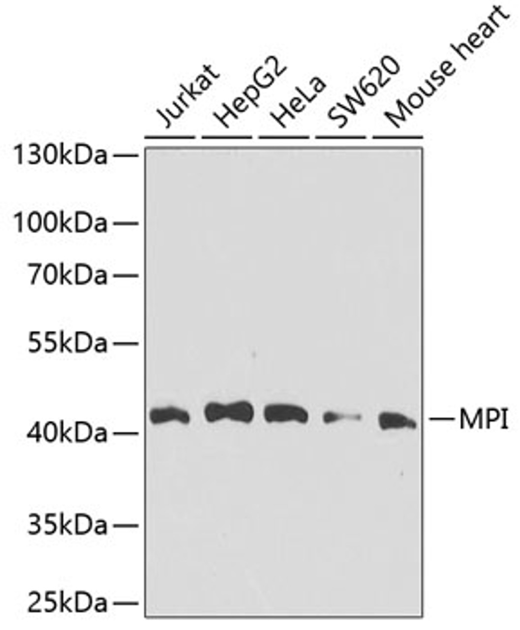 Western blot analysis of extracts of various cell lines, using MPI antibody (22-861) at 1:1000 dilution.<br/>Secondary antibody: HRP Goat Anti-Rabbit IgG (H+L) at 1:10000 dilution.<br/>Lysates/proteins: 25ug per lane.<br/>Blocking buffer: 3% nonfat dry milk in TBST.<br/>Detection: ECL Basic Kit.<br/>Exposure time: 30s.